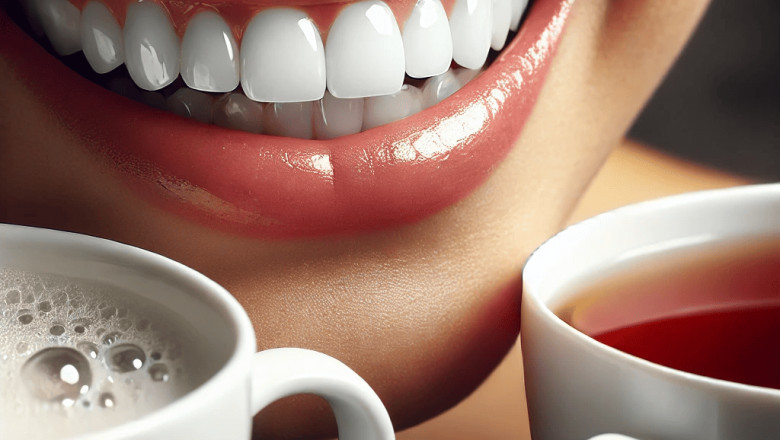 Best Teeth Whitening Options for Coffee and Tea Drinkers