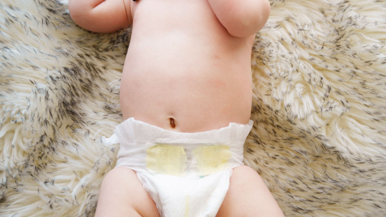 The Best Diapers for Sensitive Skin: Top Brands for Your Baby