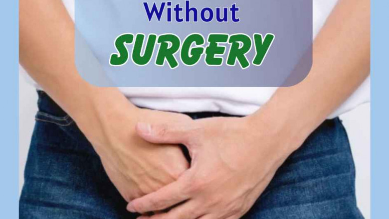 varicocele treatment without surgery