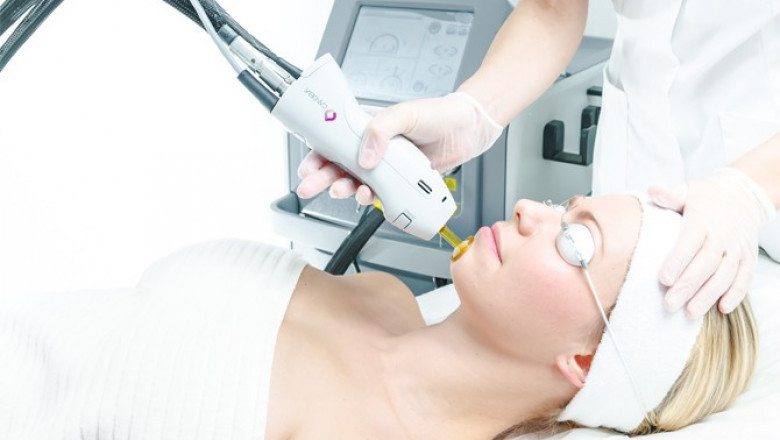 Can You Get Laser Hair Removal While Pregnant? Expert Advice
