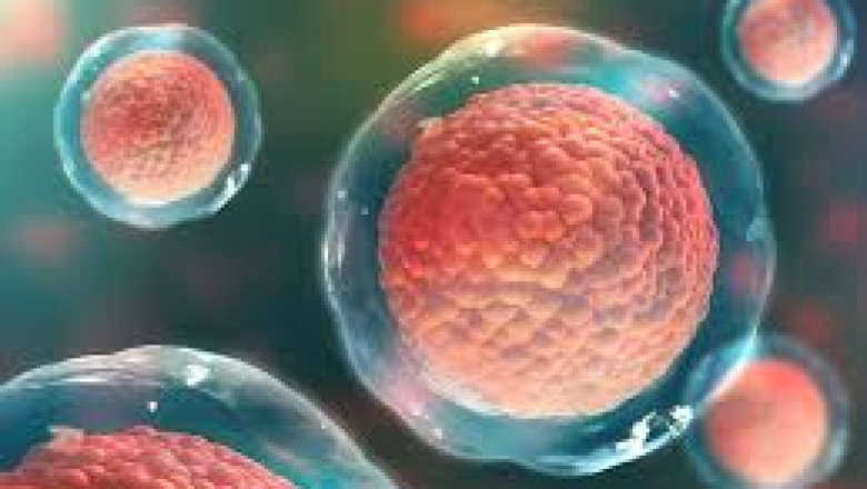 Cell-Based Assay Applications in Drug Discovery and Research