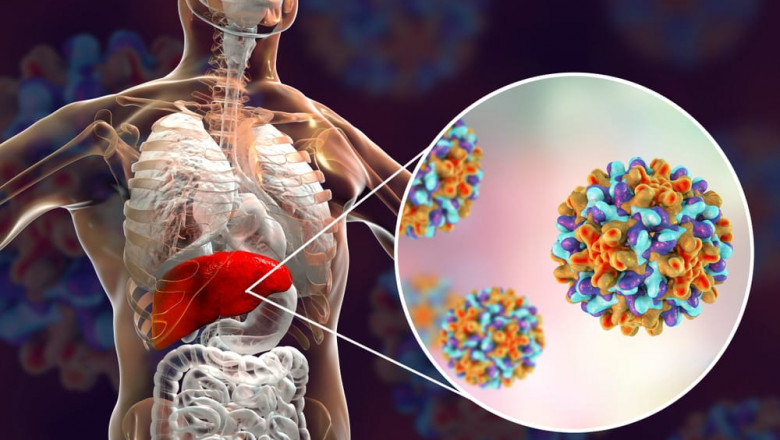 The Serious Complications of Hepatitis B: Risks, Symptoms, and Prevention