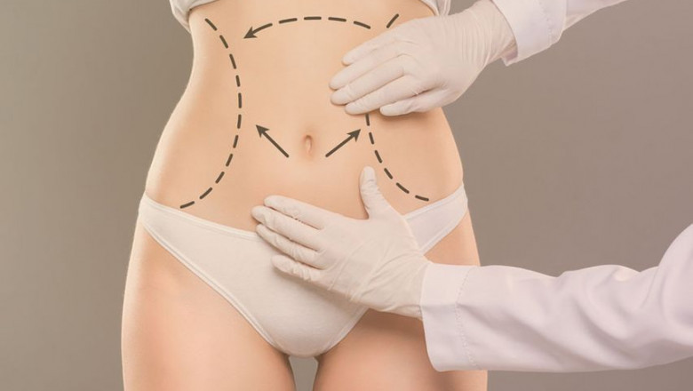 Rediscover Your Confidence with Tummy Tuck Surgery in Dubai by Dr. Hans
