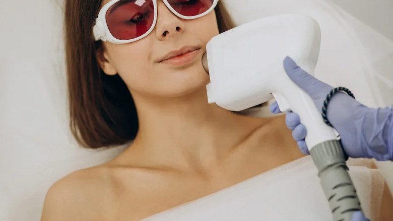 Choose the Right Clinic for Electrolysis Hair Removal Cost