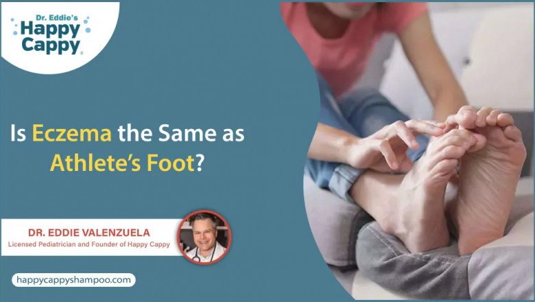 Foot Eczema Symptoms: How to Identify the Rash & Irritation