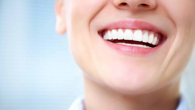 Brighten Your Smile with Professional Teeth Whitening in Las Vegas NV