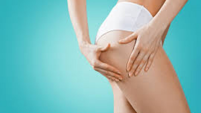 Fastest Results from Any Cellulite Treatment
