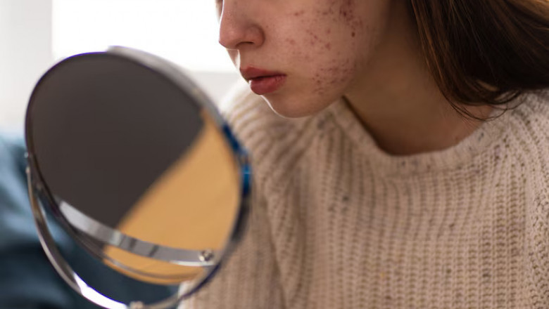 Dark Spot Corrector: The Key to Even Radiant Skin