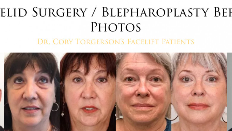 Elevating Confidence Through Precision: The Art of Facial Transformation at Dr. Cory Torgerson Facial Cosmetic Surgery & Laser Centre