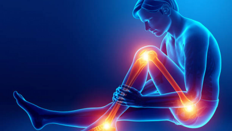 PRP for Joints in London: A Natural Solution for Joint Pain