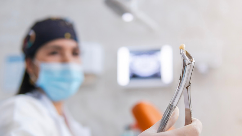 Understanding Tooth Extractions: When They're Needed and What to Expect