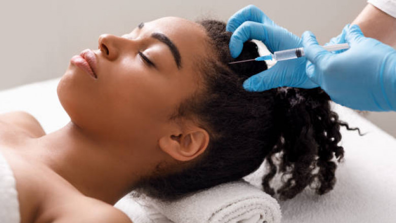 London’s Leading PRP Hair Treatment: Does It Really Work?