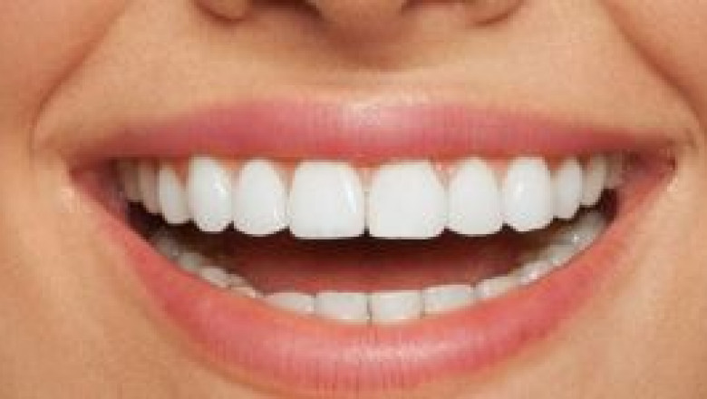 What Your Teeth Say About Your Overall Health