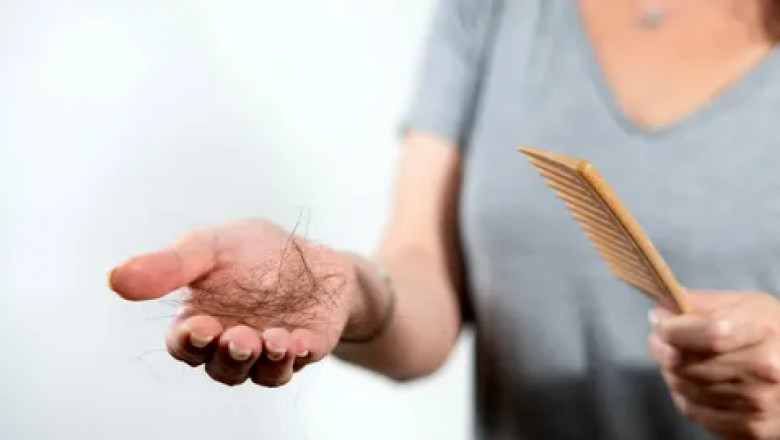 Prescription Hair Loss and Hair Removal Drugs Market Set to Witness Growth Due to Advancements in Hair Restoration Therapies