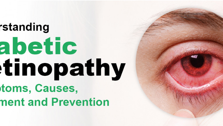 Diabetic Retinopathy: Causes, Symptoms, and Treatment