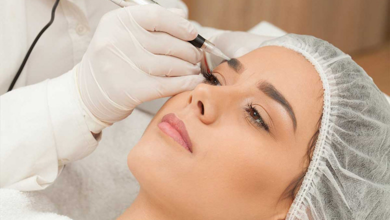 Eyebrow Transplants in Dubai a guide for you