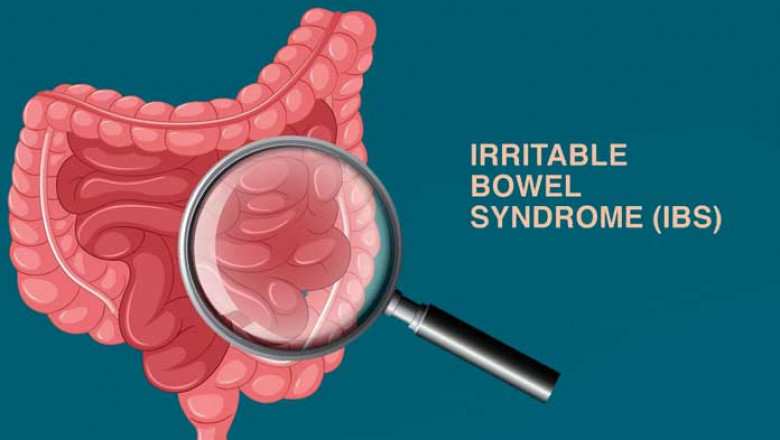 Irritable Bowel Syndrome (IBS) Diagnostics Market 2028: Size, Dynamics, and Overview