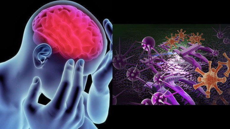 Acute Repetitive Seizures Market Estimated to Witness Growth Owing to Intranasal Therapies