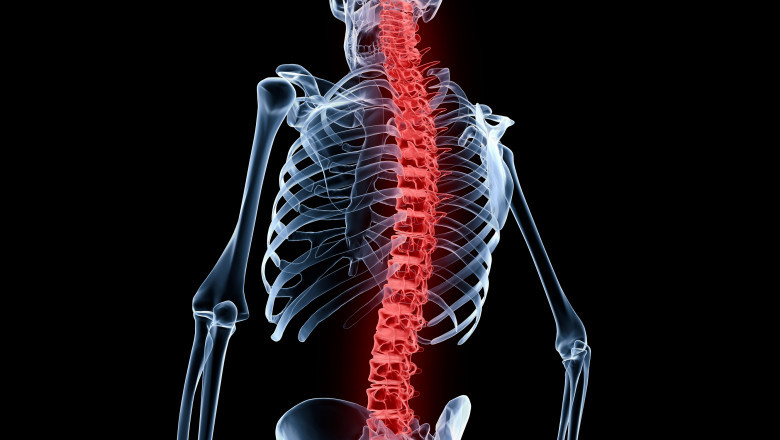 Exoskeletons and SCI: Walking Toward the Future