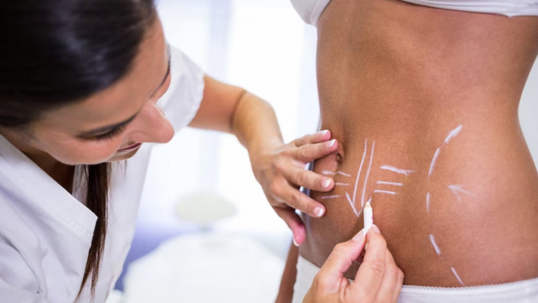 How to Maintain Your Weight After You Stop Injections