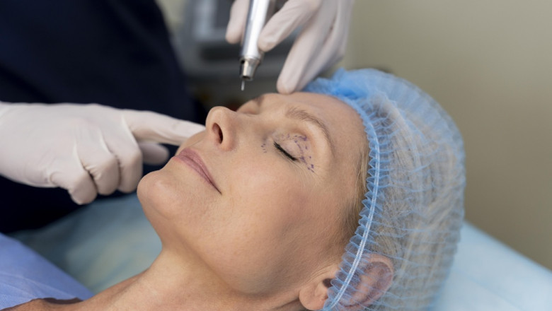 The Future of Youthful Skin: Non-Surgical Wrinkle Removal in St. Charles