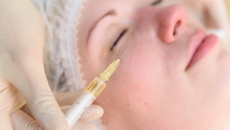 Why Everyone Is Talking About Sculptra in 2025