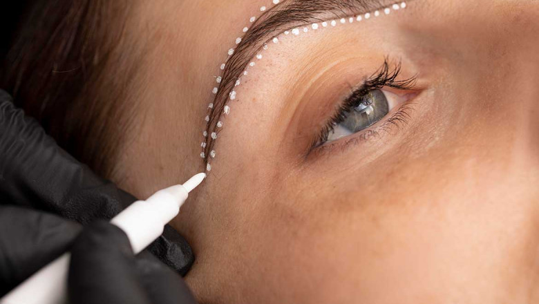Feminine vs Masculine Brow Shapes: Transplant Techniques That Match