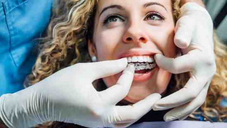 Friendly Dental Teams Supporting You in Bicester