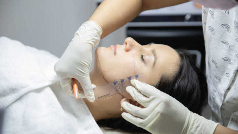 Understanding Belkyra Kybella Treatment: Your Guide to a Defined Jawline