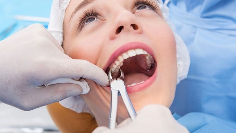 Expert Tooth Extraction in Dubai: Safe, Painless Dental Care