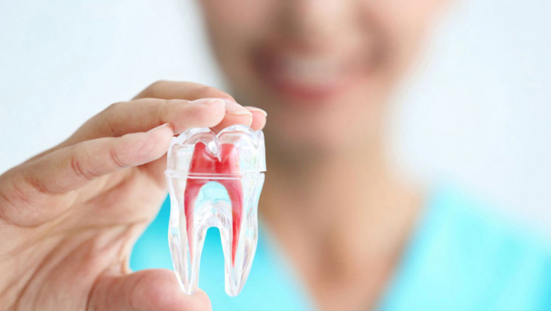 Smile Savers: Your Ultimate Guide to Root Canal Treatment UAE