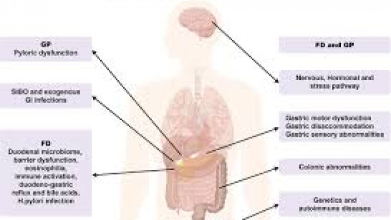 How to Use Caverta 50 mg for Best Results?