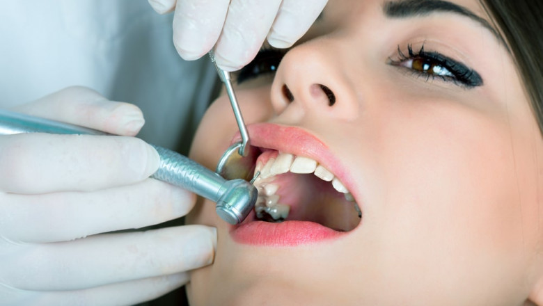 Crawfordville FL Dental Implant Solutions That Fit Your Budget