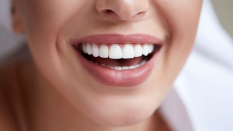 Dental Implants in Avon, Ohio – Restore Your Smile with Permanent, Natural-Looking Solutions