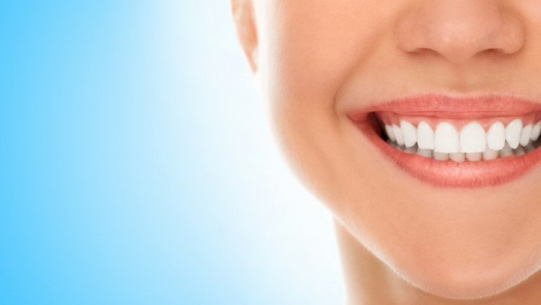 Dental Veneers: A Simple Way to Improve Your Smile
