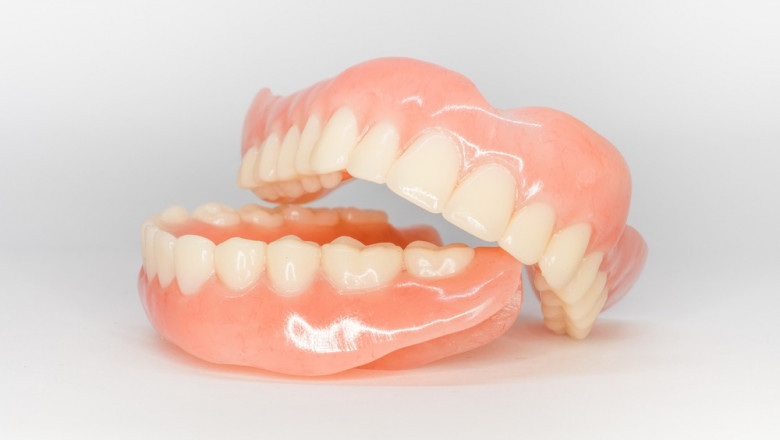 Dentures Longview TX - Restore Your Smile With Custom Dentures