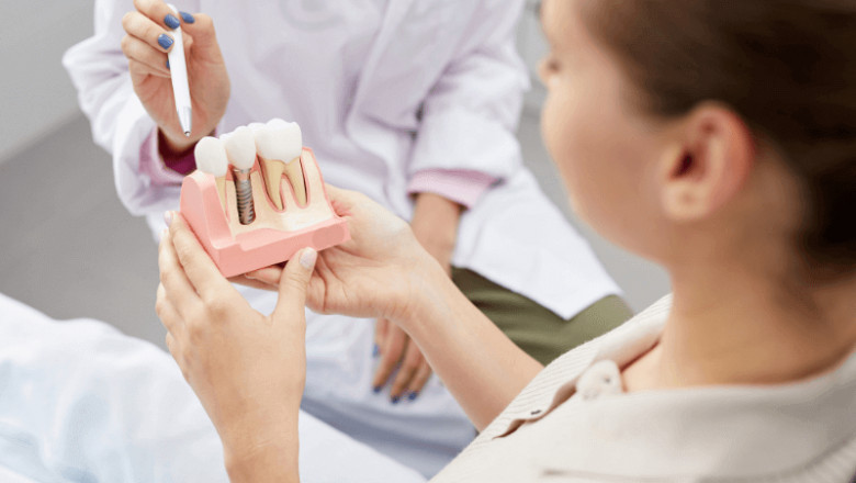 Exploring the Cost of Dental Implants in Cleveland, TN