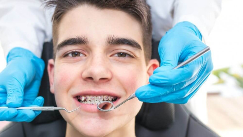 Precision Smile Correction with Invisalign in Fort Walton Beach FL
