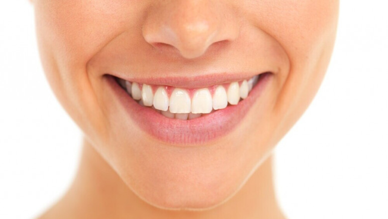 Smile Makeover: Transform Your Smile and Boost Your Confidence