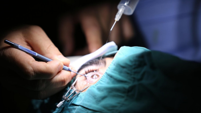 Cataract Surgery in Mumbai: Cost, Procedure, and Top Surgeons You Can Trust