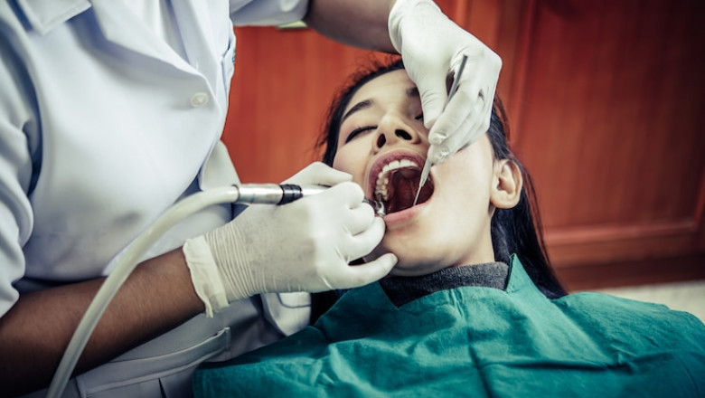Dental Implant Cost in Chennai – Cost & Estimate