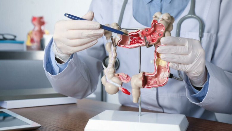 Gastroenterology Treatments: A Comprehensive Overview