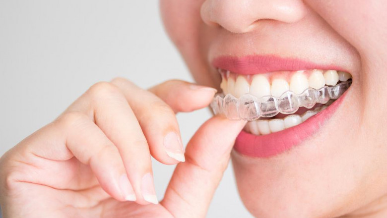 Crest Whitening – Achieve a Brighter Smile with The White Smiles